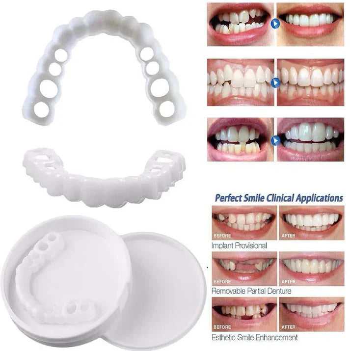 Snap-On Smile Removable Dental Veneers